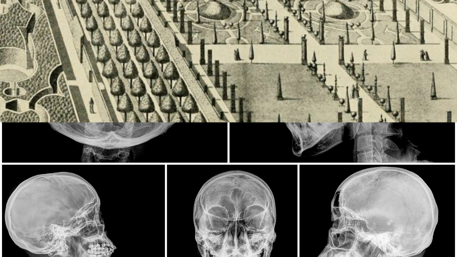 The top half of this collaged image is a black & white drawing of a large and orderly garden, and the bottom half is an x-ray of a human skull from multiple angles.